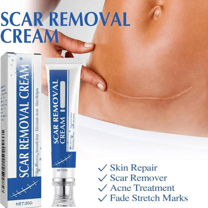 Advanced Silicone Scar Removal Cream