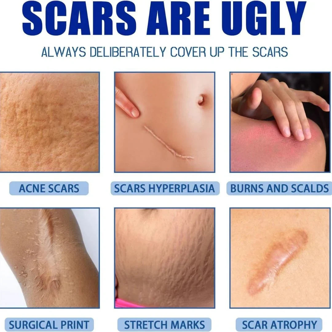Advanced Silicone Scar Removal Cream