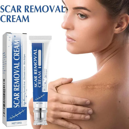 Advanced Silicone Scar Removal Cream